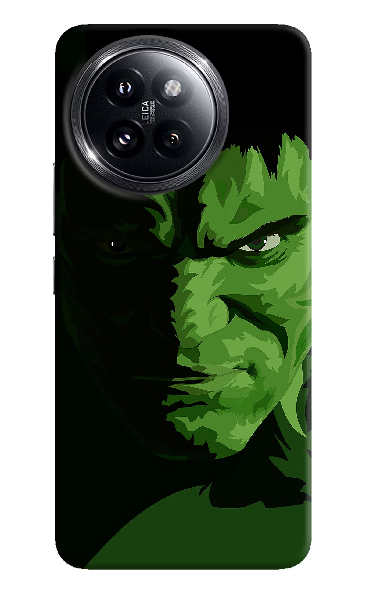 HULK Xiaomi 14 Civi Hard Case Back Cover by Casekaro