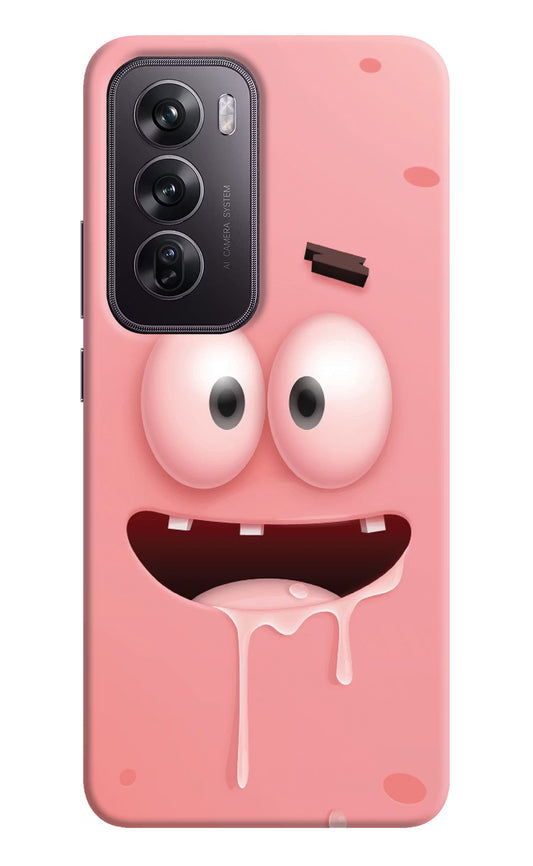 Sponge 2 Oppo Reno12 Pro 5G Hard Case Back Cover by Casekaro