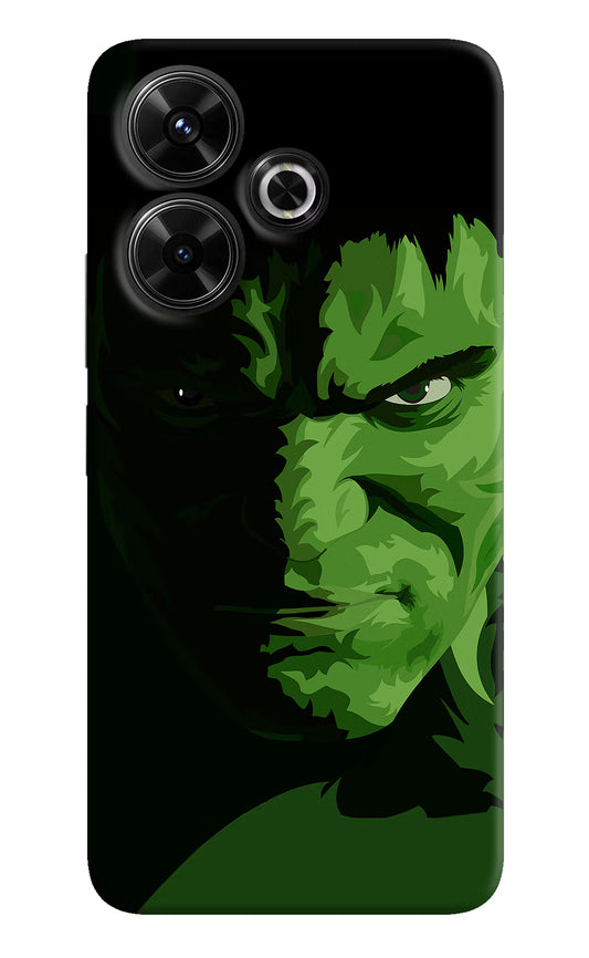 HULK Redmi 13 5G Hard Case Back Cover by Casekaro