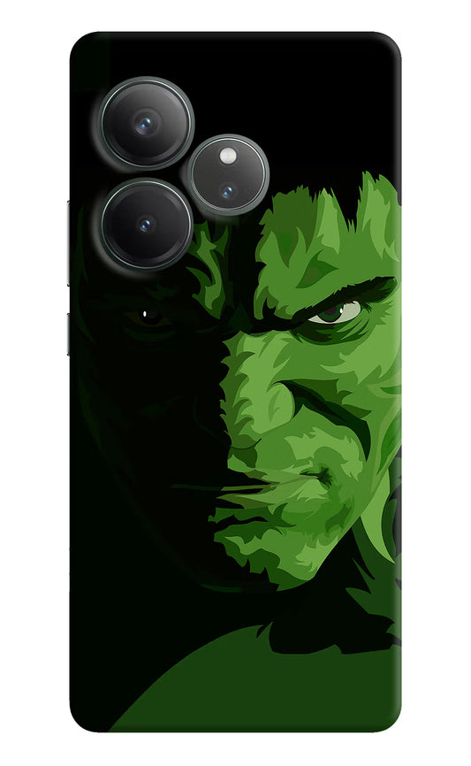 HULK Realme GT 6 Hard Case Back Cover by Casekaro