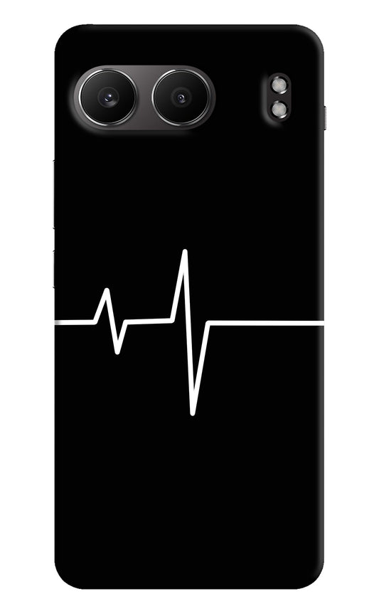 Heart Beats OnePlus Nord 4 Back Cover