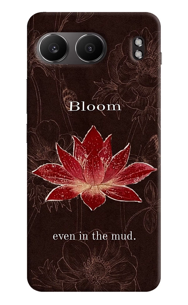 Bloom OnePlus Nord 4 Hard Case Back Cover by Casekaro