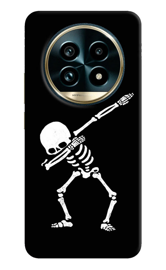 Dabbing Skeleton Art Realme 13 Pro+ 5G Hard Case Back Cover by Casekaro