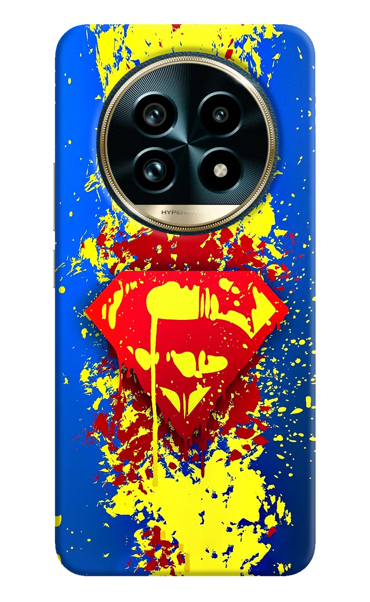 Superman logo Realme 13 Pro+ 5G Hard Case Back Cover by Casekaro