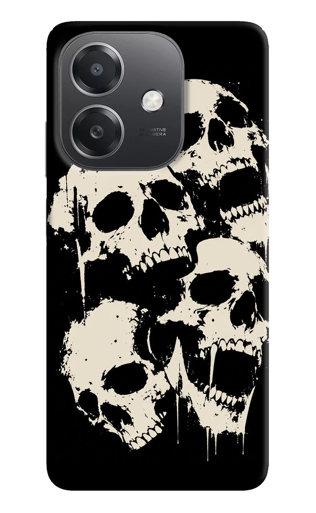 Dead Stack OPPO A3x Hard Case Back Cover by Casekaro