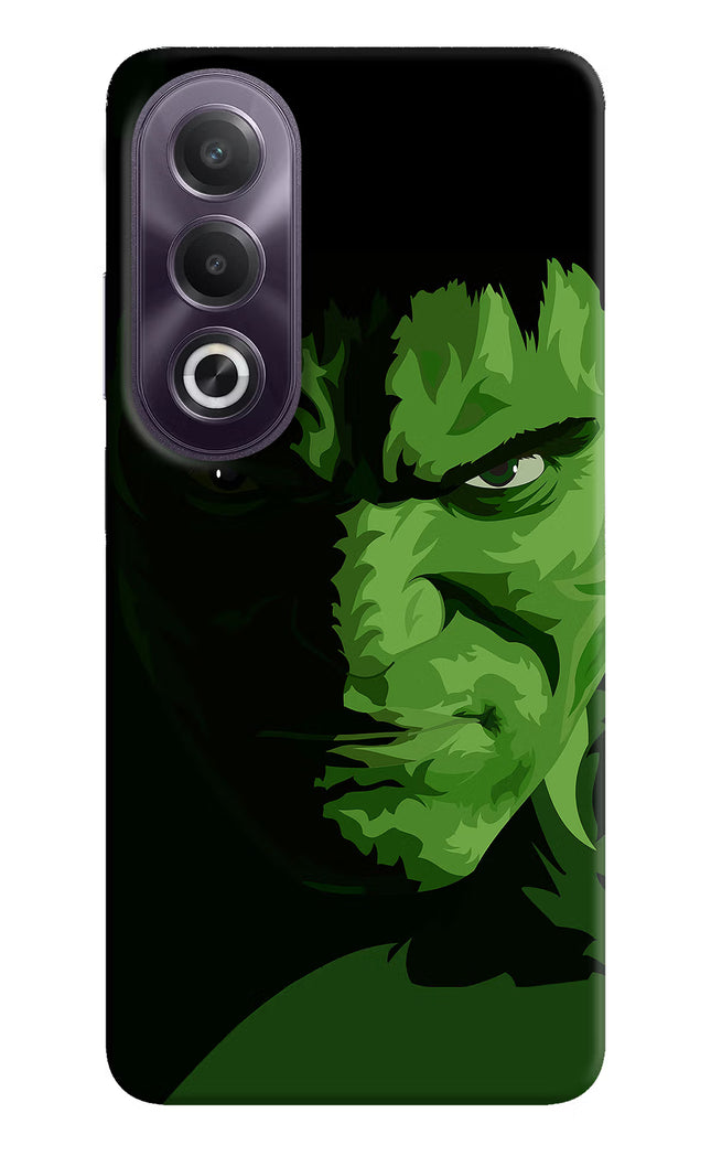 HULK OPPO K12x Hard Case Back Cover by Casekaro