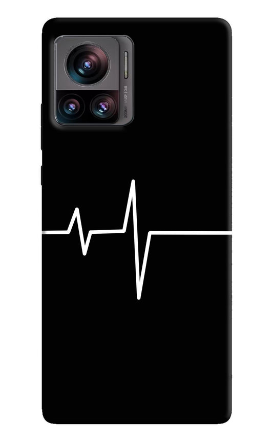 Heart Beats Moto Edge 30 Ultra Back Cover