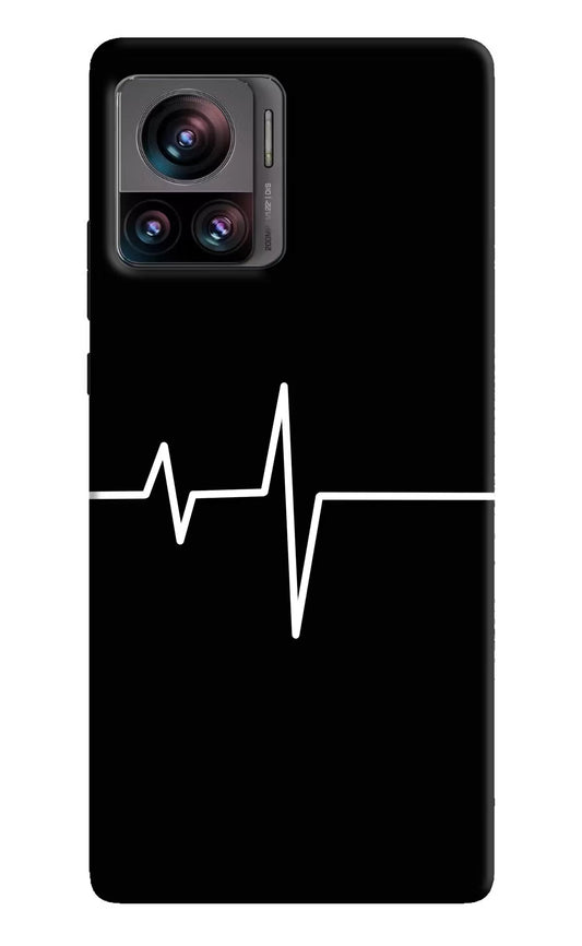 Heart Beats Moto Edge 30 Ultra Hard Case Back Cover by Casekaro