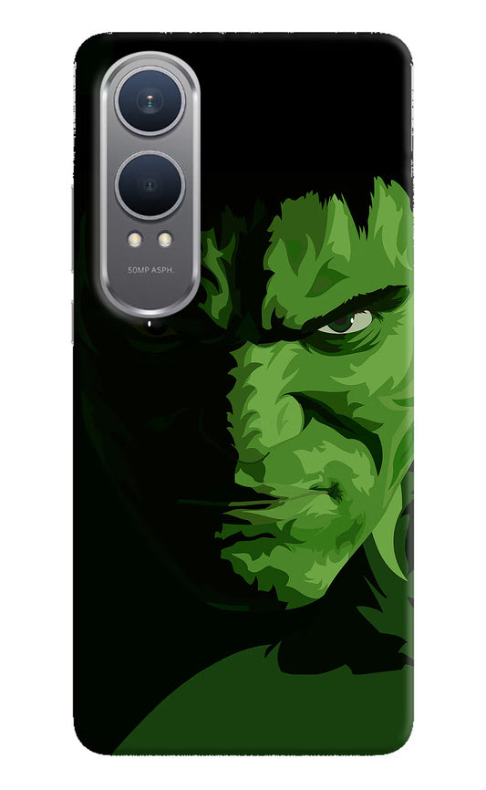 HULK OnePlus Nord CE4 Lite Hard Case Back Cover by Casekaro