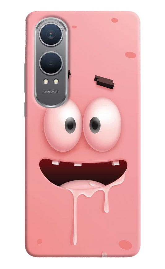 Sponge 2 OnePlus Nord CE4 Lite Hard Case Back Cover by Casekaro