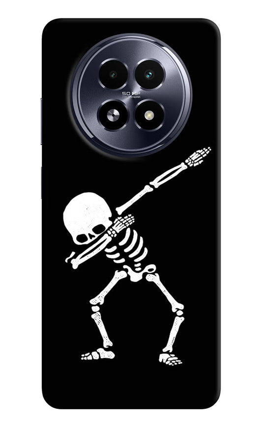 Dabbing Skeleton Art Realme 13 5G Hard Case Back Cover by Casekaro