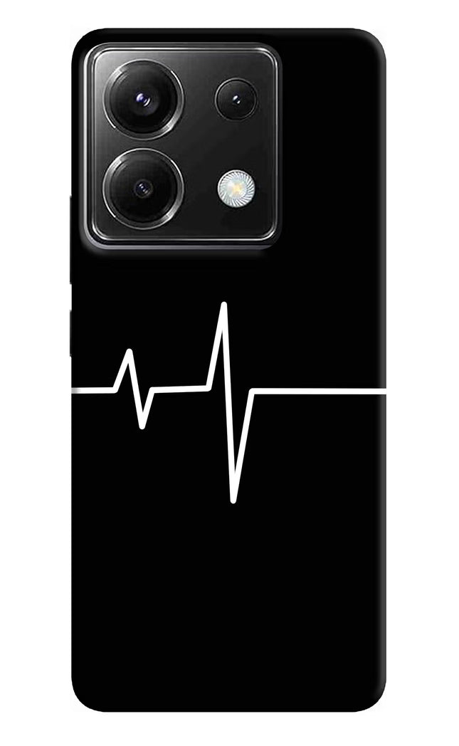 Heart Beats Poco X6 Hard Case Back Cover by Casekaro