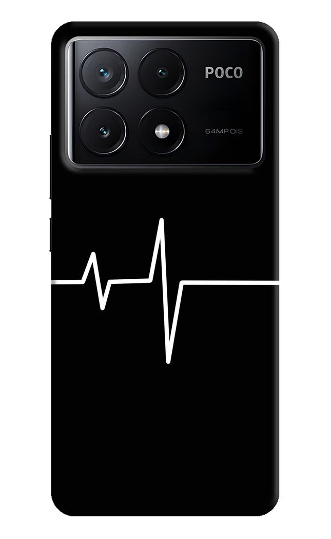 Heart Beats Poco X6 Pro Hard Case Back Cover by Casekaro