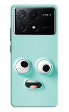 Funny Cartoon Poco X6 Pro Hard Case Back Cover by Casekaro