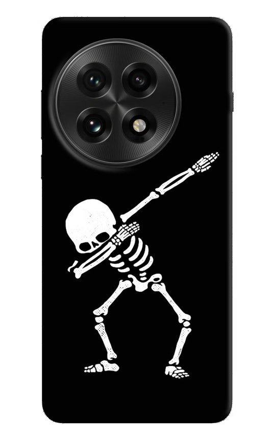 Dabbing Skeleton Art OnePlus 13 Hard Case Back Cover by Casekaro