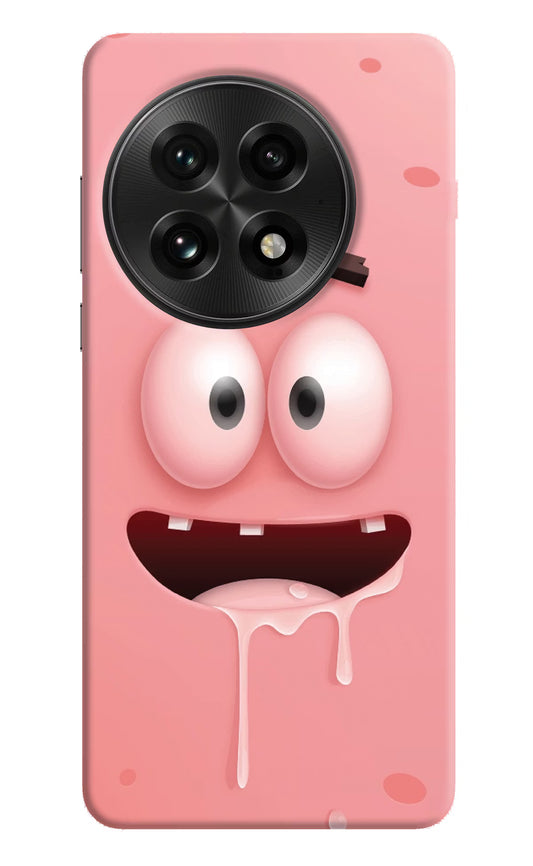 Sponge 2 OnePlus 13 Hard Case Back Cover by Casekaro