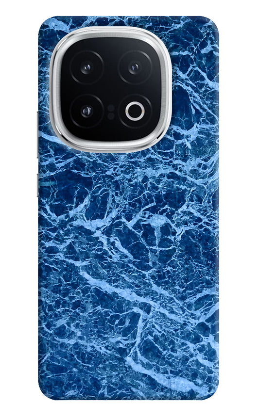 Blue Marble iQOO 13 5G Hard Case Back Cover by Casekaro