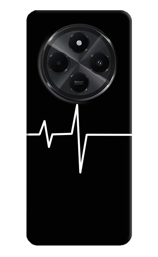 Heart Beats Redmi A4 5G Hard Case Back Cover by Casekaro