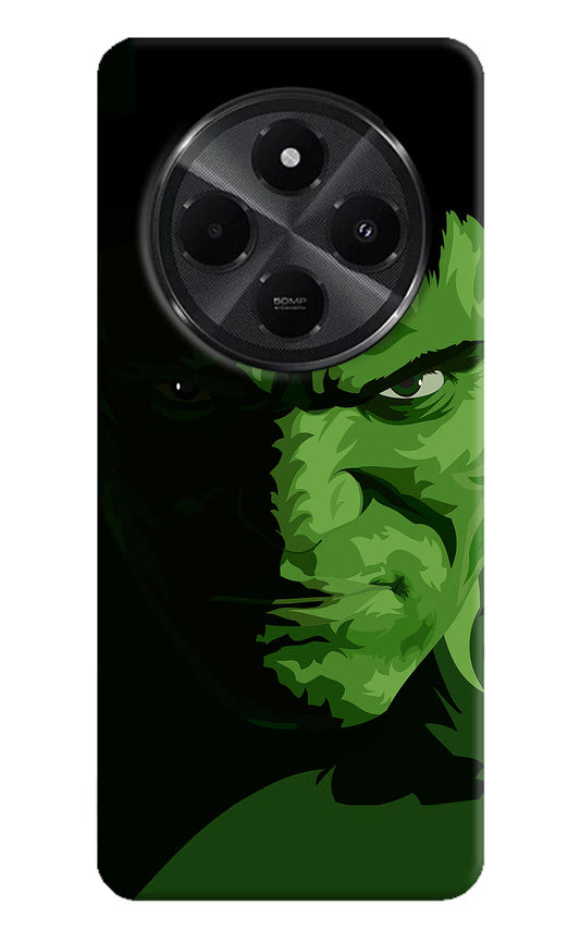 HULK Redmi A4 5G Hard Case Back Cover by Casekaro