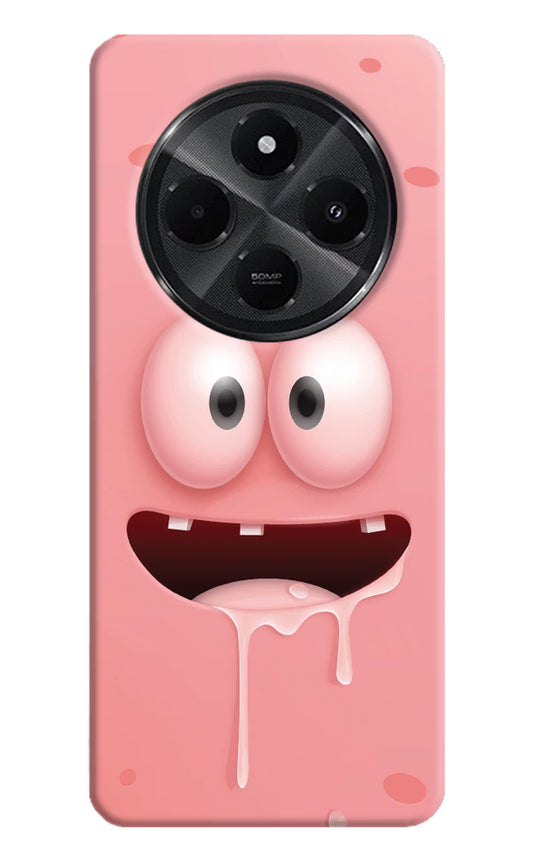 Sponge 2 Redmi A4 5G Hard Case Back Cover by Casekaro