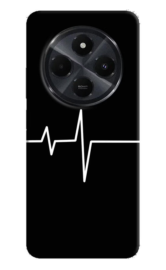 Heart Beats Redmi 14C 5G Hard Case Back Cover by Casekaro