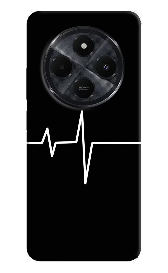 Heart Beats Redmi 14C 5G Hard Case Back Cover by Casekaro