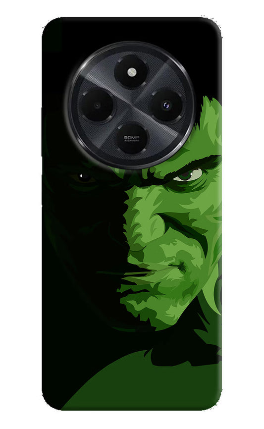 HULK Redmi 14C 5G Hard Case Back Cover by Casekaro