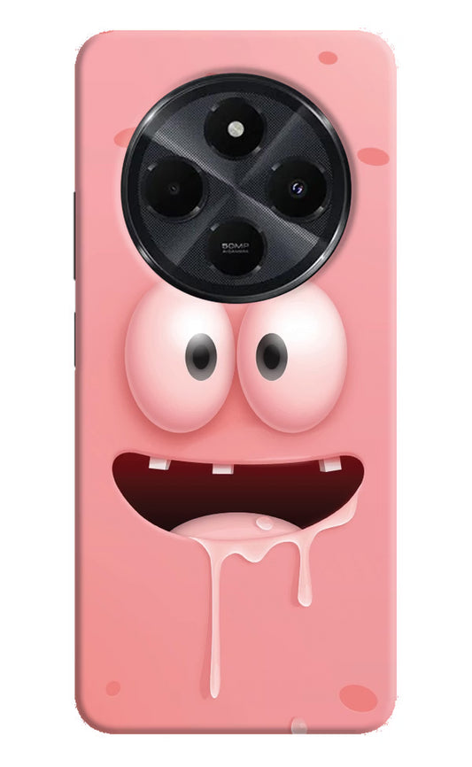 Sponge 2 Redmi 14C 5G Hard Case Back Cover by Casekaro