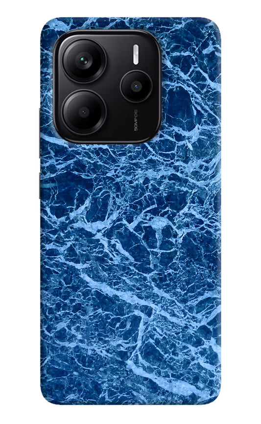 Blue Marble Redmi Note 14 5G Hard Case Back Cover by Casekaro