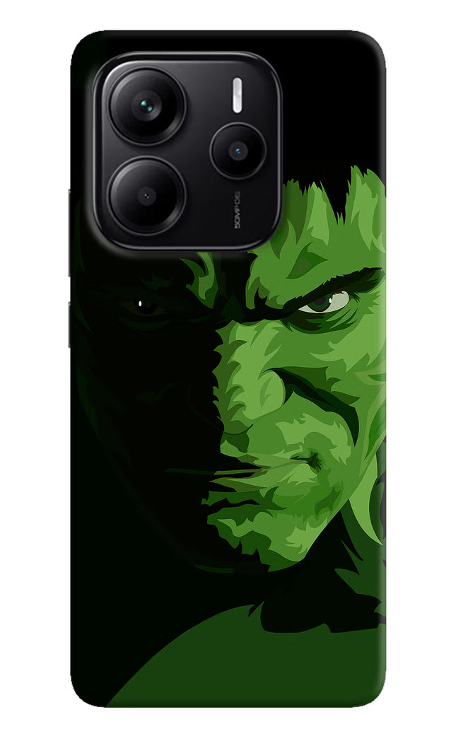 HULK Redmi Note 14 5G Hard Case Back Cover by Casekaro
