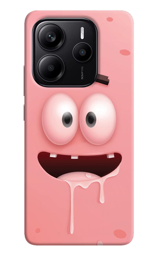 Sponge 2 Redmi Note 14 5G Hard Case Back Cover by Casekaro