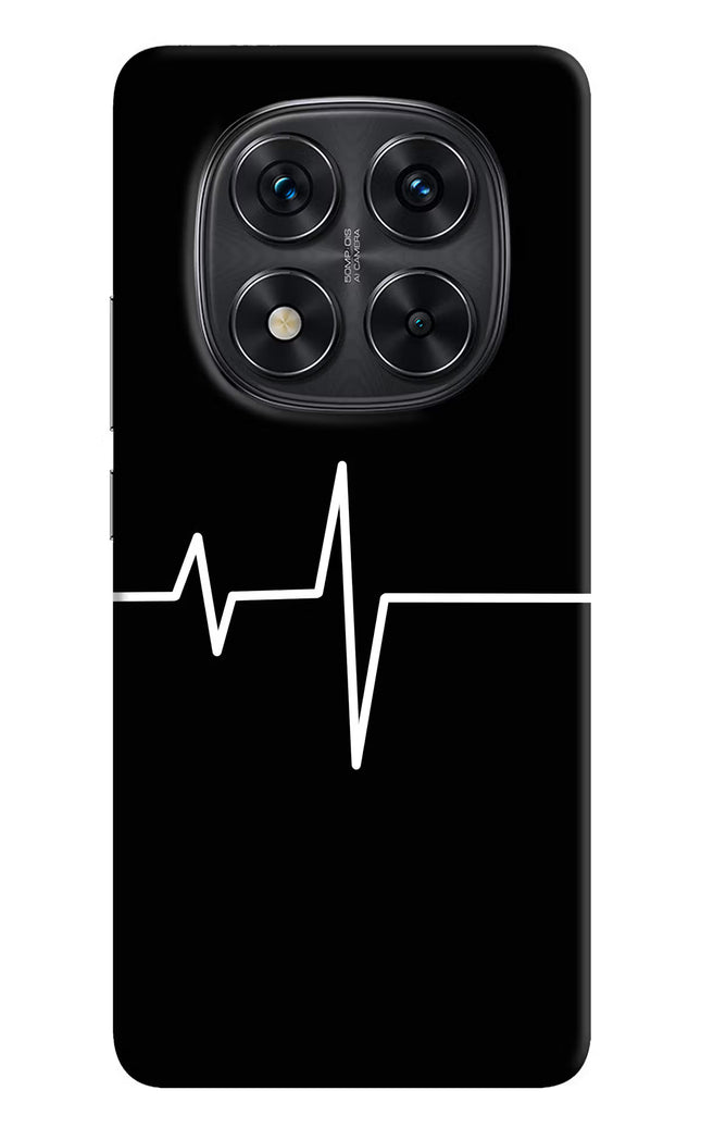 Heart Beats Redmi Note 14 Pro 5G Hard Case Back Cover by Casekaro