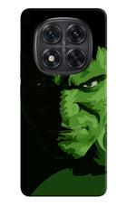 HULK Redmi Note 14 Pro 5G Hard Case Back Cover by Casekaro