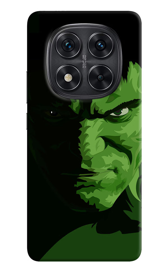 HULK Redmi Note 14 Pro 5G Hard Case Back Cover by Casekaro