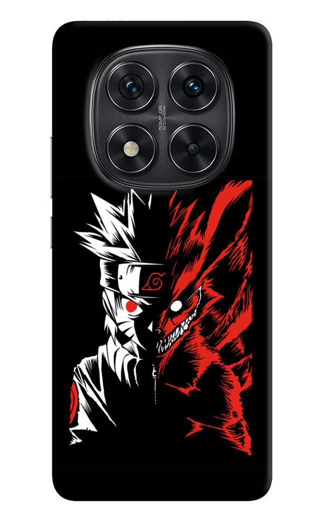 Naruto Two Face Redmi Note 14 Pro 5G Hard Case Back Cover by Casekaro