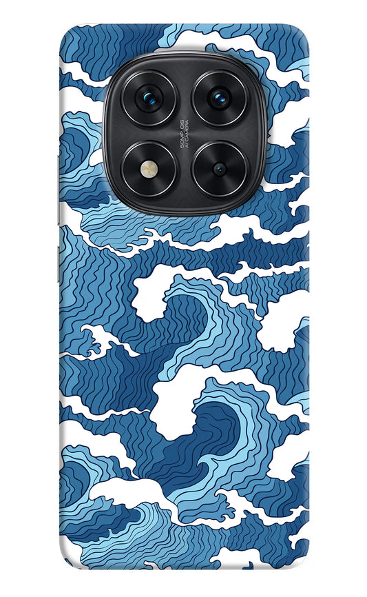 Blue Waves Redmi Note 14 Pro 5G Hard Case Back Cover by Casekaro