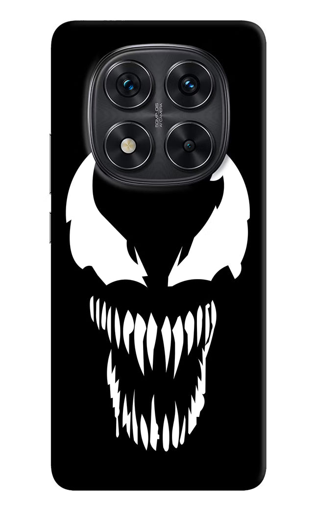 Venom Redmi Note 14 Pro 5G Hard Case Back Cover by Casekaro