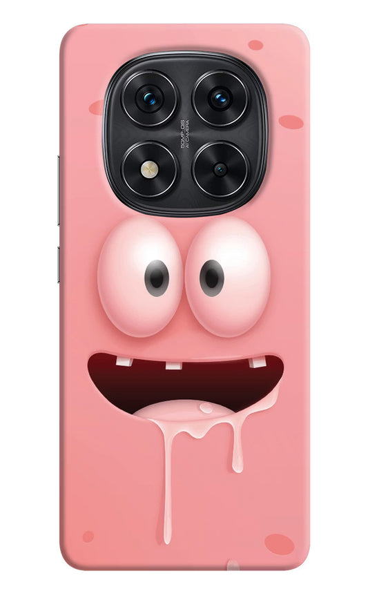 Sponge 2 Redmi Note 14 Pro 5G Hard Case Back Cover by Casekaro