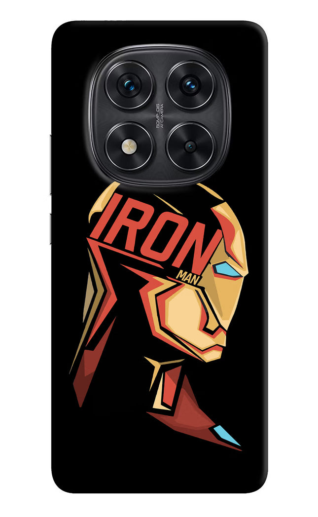 IronMan Redmi Note 14 Pro 5G Hard Case Back Cover by Casekaro