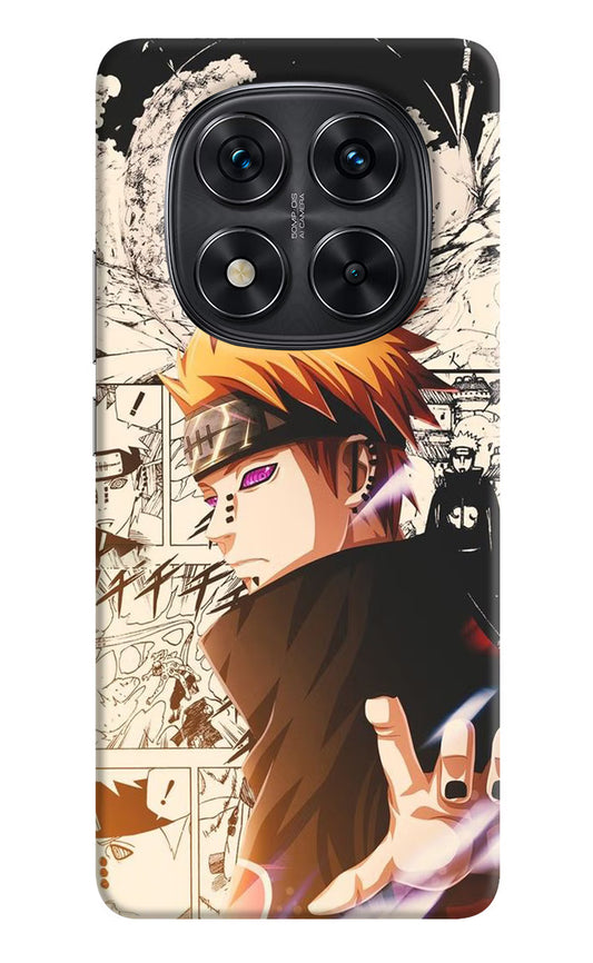 Pain Anime Redmi Note 14 Pro 5G Hard Case Back Cover by Casekaro