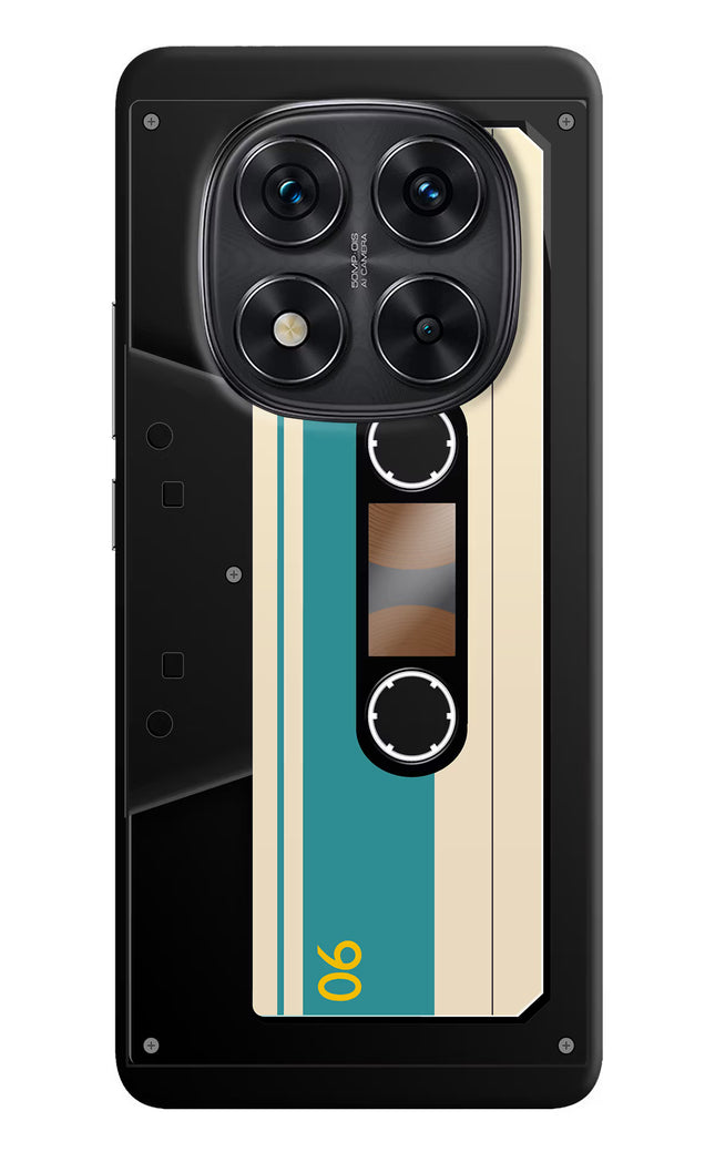 Cassette Redmi Note 14 Pro 5G Hard Case Back Cover by Casekaro