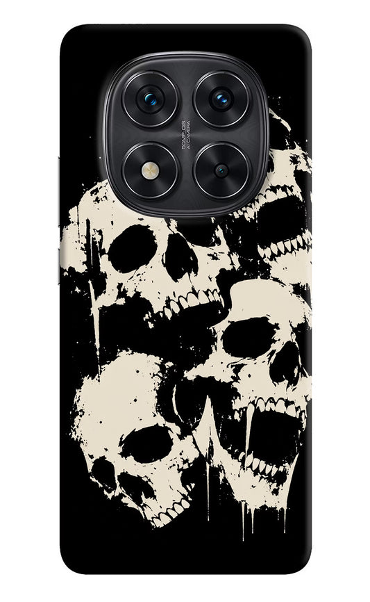 Dead Stack Redmi Note 14 Pro 5G Hard Case Back Cover by Casekaro