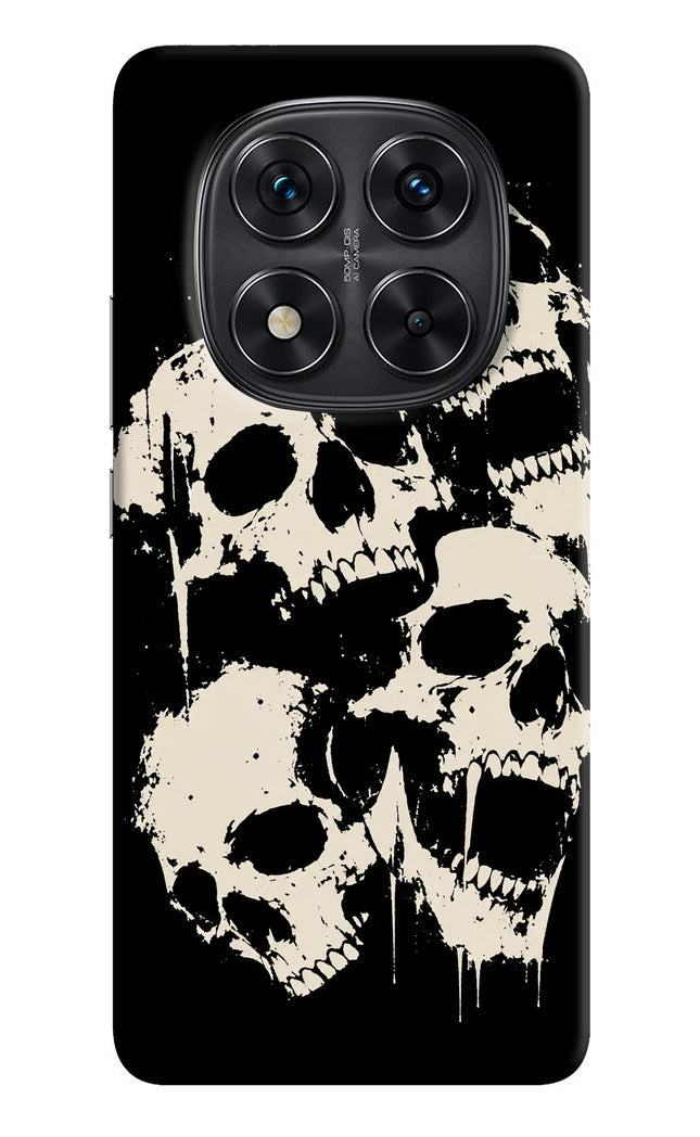Dead Stack Redmi Note 14 Pro 5G Hard Case Back Cover by Casekaro
