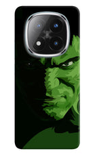 HULK Redmi Note 14 Pro Plus 5G Hard Case Back Cover by Casekaro