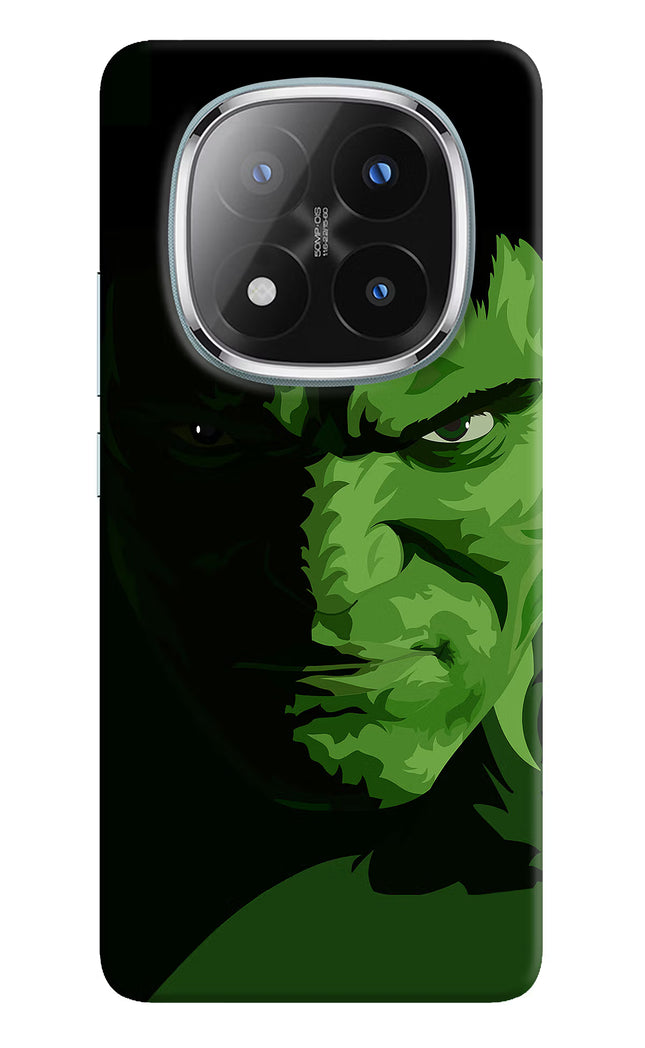HULK Redmi Note 14 Pro Plus 5G Hard Case Back Cover by Casekaro