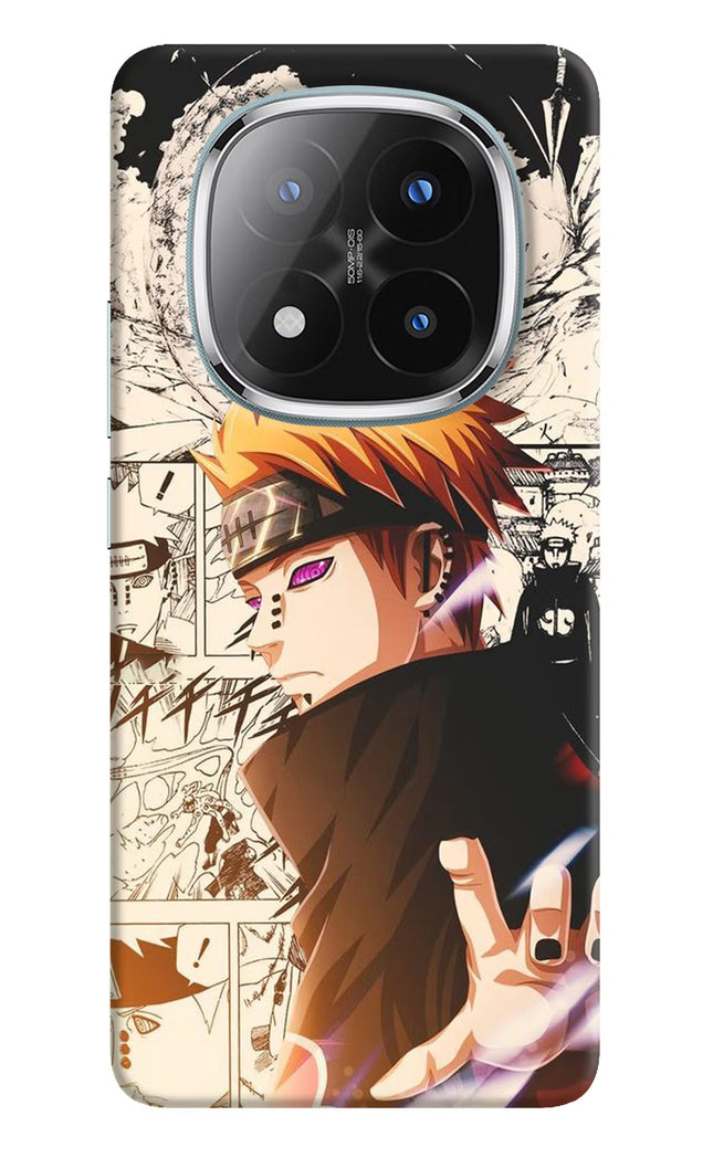 Pain Anime Redmi Note 14 Pro Plus 5G Hard Case Back Cover by Casekaro