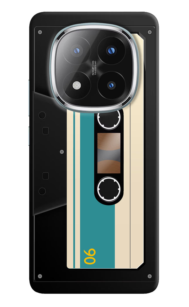 Cassette Redmi Note 14 Pro Plus 5G Hard Case Back Cover by Casekaro