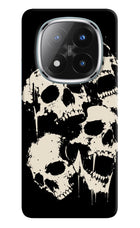 Dead Stack Redmi Note 14 Pro Plus 5G Hard Case Back Cover by Casekaro
