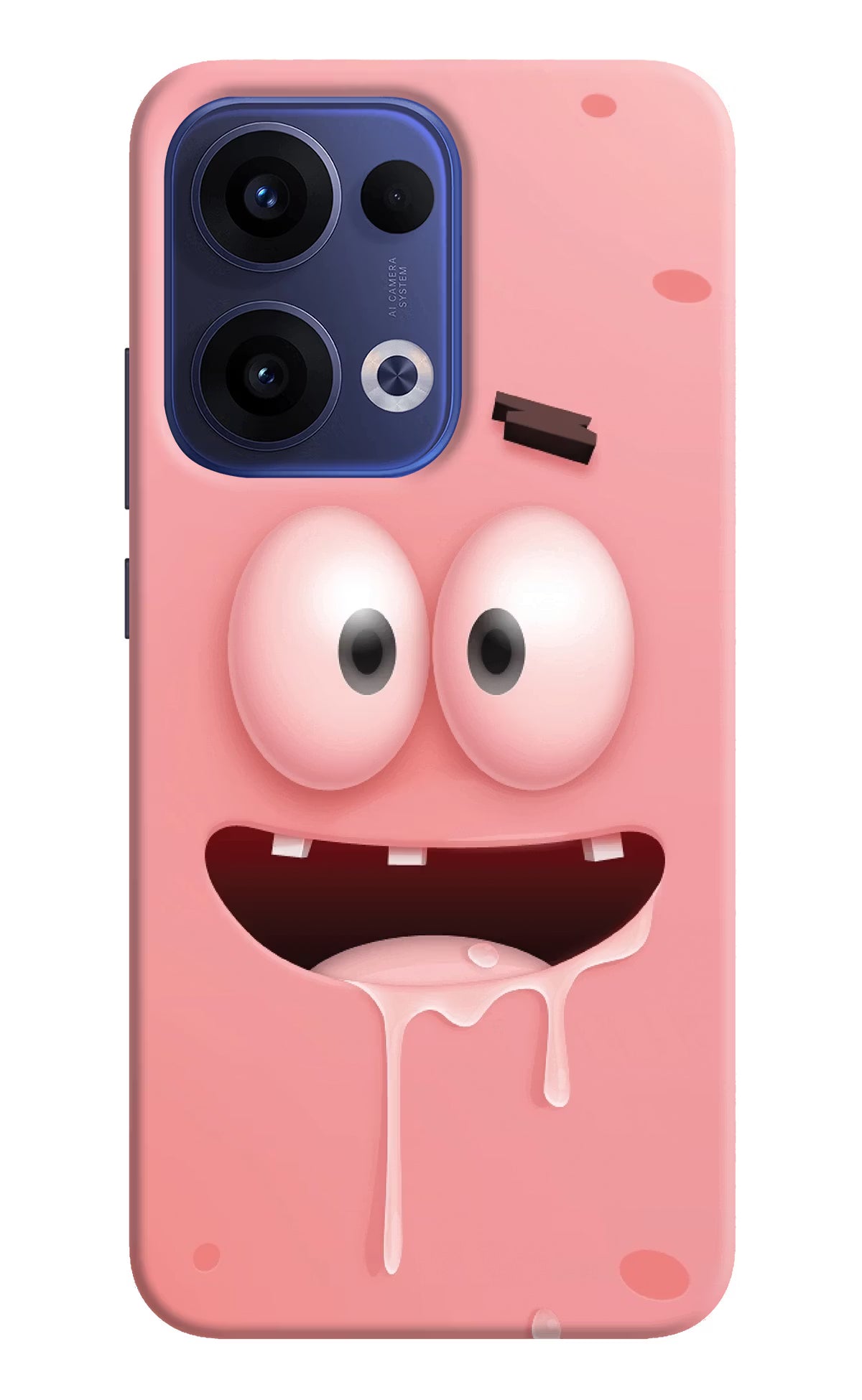 Sponge 2 Oppo Reno13 5G Hard Case Back Cover by Casekaro