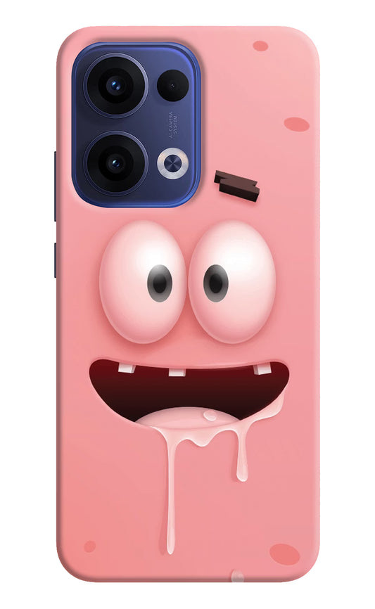 Sponge 2 Oppo Reno13 5G Hard Case Back Cover by Casekaro